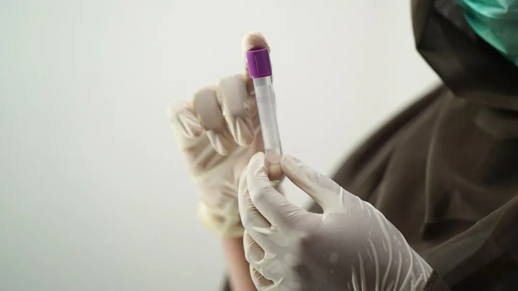 Two hands holding a drug test blood vial 